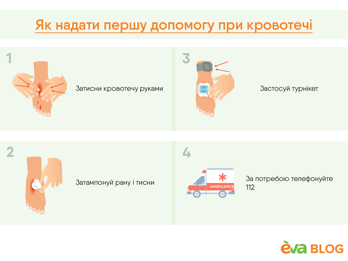 Как оказать первую помощь при: кровотечении, ожоге, обмороке, ранении » Eva Blog